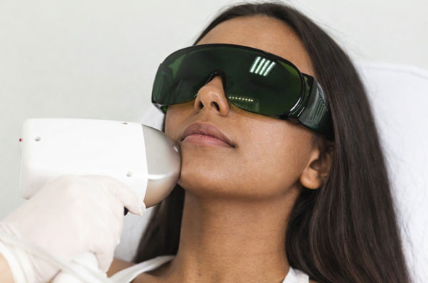 Laser Skin Treatment